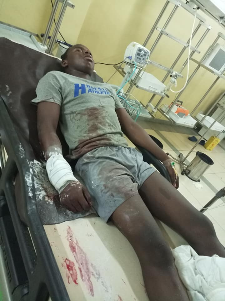 Nigerian lady cries out for justice for her cousin who suffered gunshot injury after he was allegedly attacked by SARS officials in Abuja (photos)