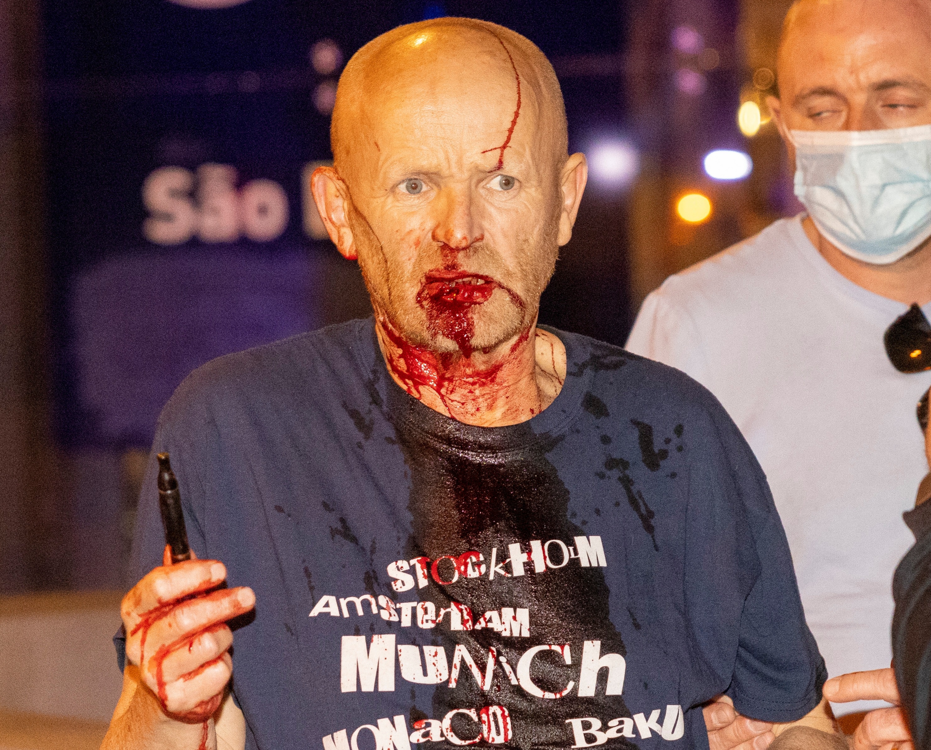 A football fan was seen on Thursday night covered in blood