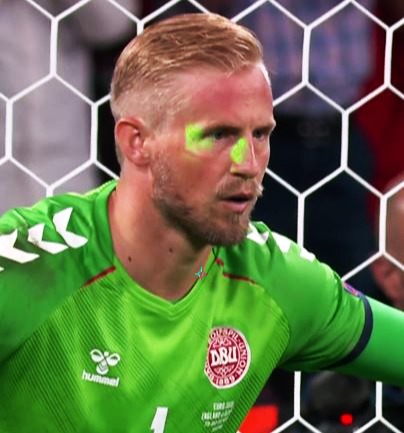 An fan shone a laser in the face of Kasper Schmeichel